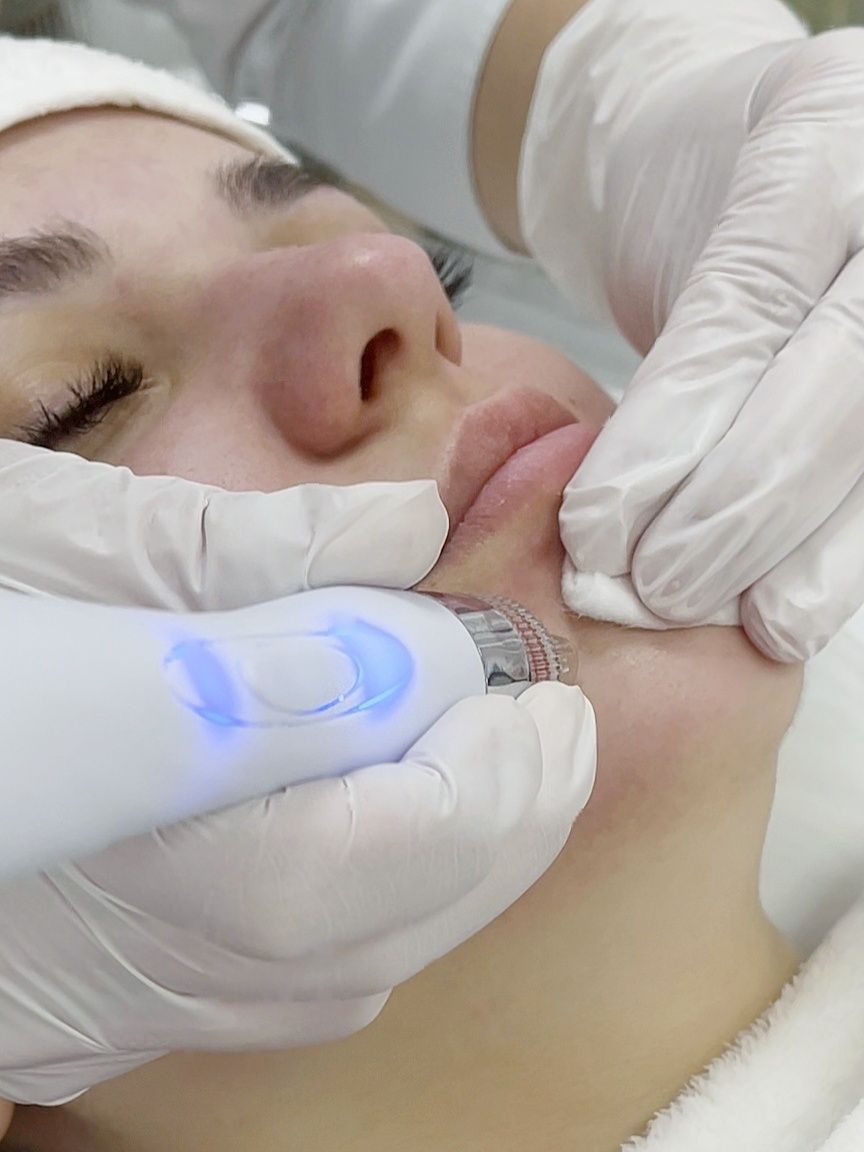 Limpieza facial profunda