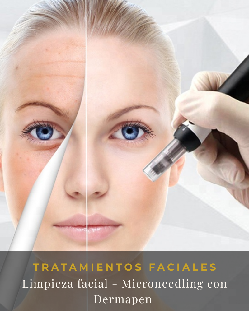 Limpieza facial - Microneedling con Dermapen